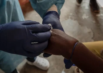 El Reino Unido confirma el primer caso de una nueva variante más contagiosa de mpox