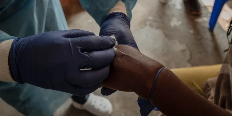 El Reino Unido confirma el primer caso de una nueva variante más contagiosa de mpox