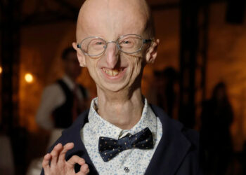 Muere a los 28 años Sammy Basso, la persona con envejecimiento prematuro más longeva del mundo