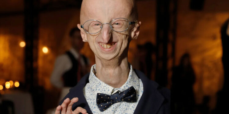Muere a los 28 años Sammy Basso, la persona con envejecimiento prematuro más longeva del mundo