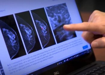 Foro reunirá a expertos para abordar el uso de la IA en cáncer de mama en América Latina