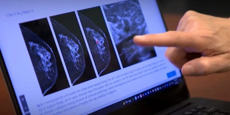 Foro reunirá a expertos para abordar el uso de la IA en cáncer de mama en América Latina