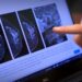 Foro reunirá a expertos para abordar el uso de la IA en cáncer de mama en América Latina