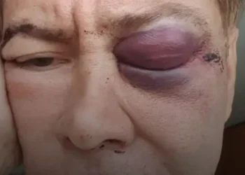 Murió el diseñador de modas Luis Braccal luego de recibir una golpiza en un centro comercial