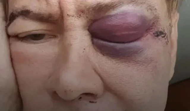 Murió el diseñador de modas Luis Braccal luego de recibir una golpiza en un centro comercial