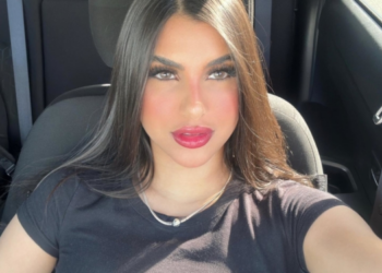 La víctima podría perder una pierna: Influencer zuliana Valeria Carruyo señalada en caso de accidente de tránsito