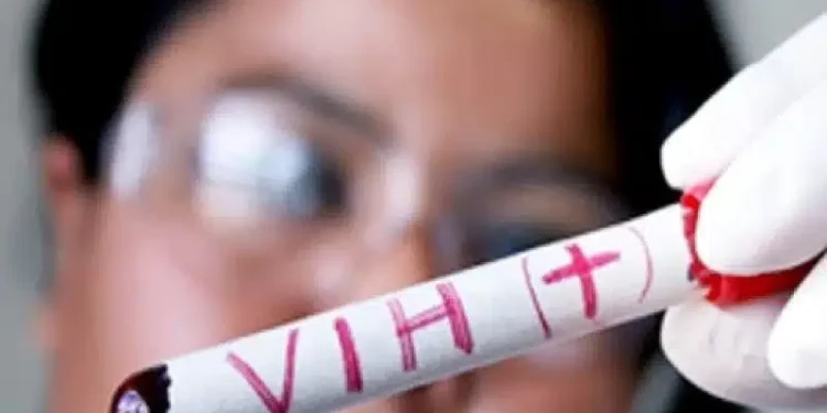 Médico venezolano explica cómo el lenacapavir bloquea la entrada del VIH a las células